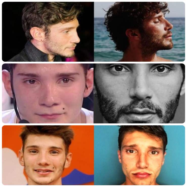 Stefano De Martino e i ritocchini estetici