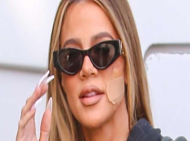 Khloè kardashian dopo intervento tumore